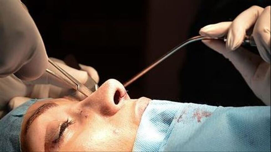 Almanya’da doktorlara 'estetik paylaşım' yasağı! Artık 'öncesi-sonrası' fotoğrafları paylaşılamayacak - 2. Resim