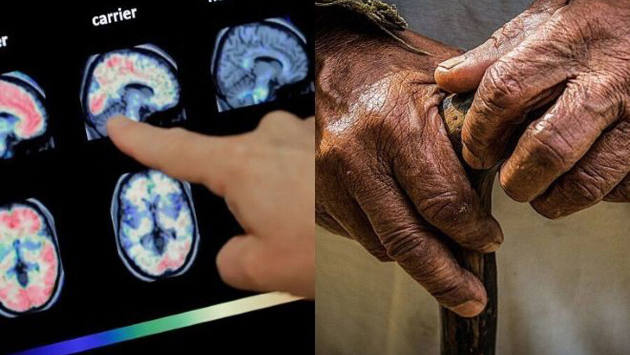 Beyin yaşlanmasını yavaşlatıyor! Bilim insanları 86 bin kişiyi inceledi ve... - 1. Resim