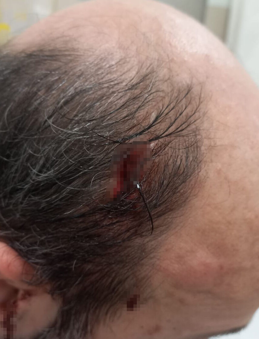 Takside ücret kavgası! "Soyunurum" diyerek tehdit edip şoförü yaraladı - 2. Resim