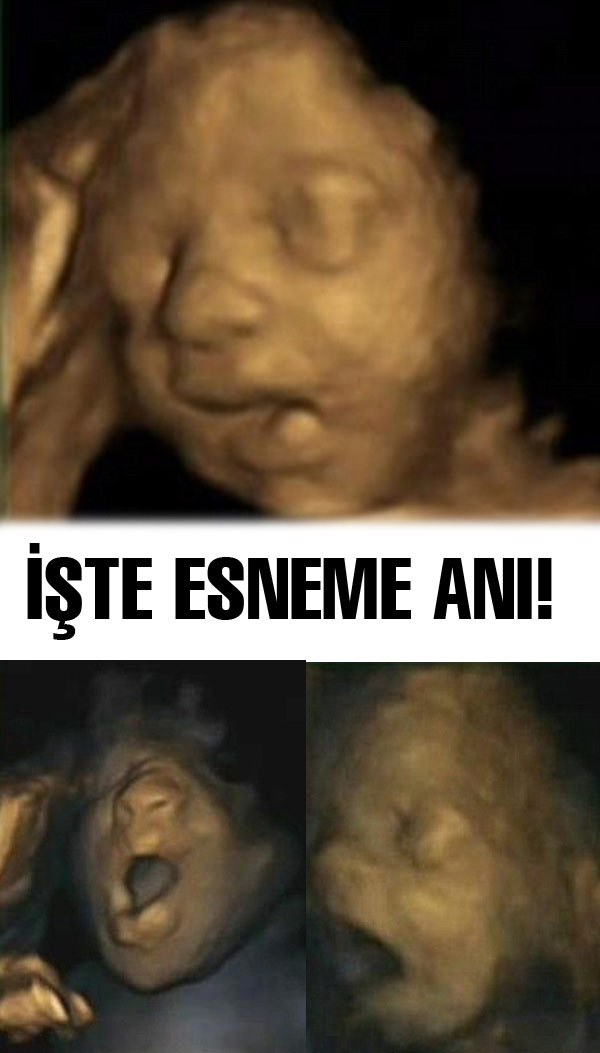 Bebeğin anne rahminde esnediği an Bebeğin anne rahminde esnediği an