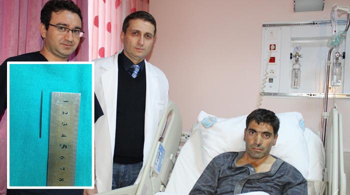Yuttuğu iğne kalbine saplandı Yuttuğu iğne kalbine saplandı