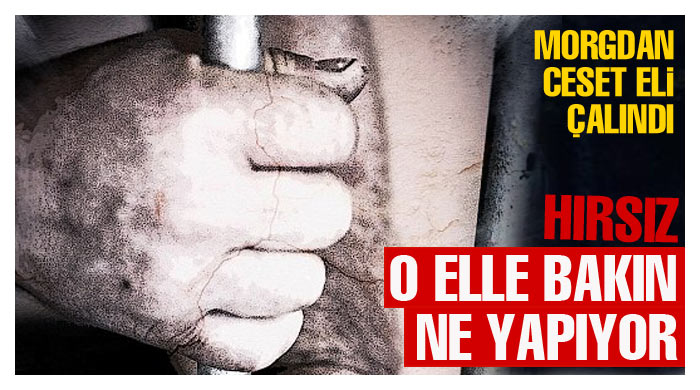 Morgdan ceset eli çalındı Morgdan ceset eli çalındı
