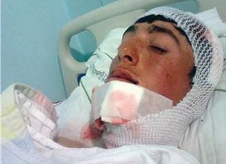 Ölü taklidi yaparak kurtuldu Ölü taklidi yaparak kurtuldu