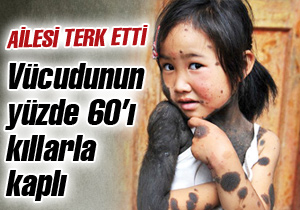 Vücudunun yüzde 60'ı kıllarla kaplı Vücudunun yüzde 60'ı kıllarla kaplı