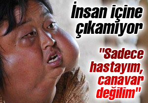 "Sadece hastayım, canavar değilim" "Sadece hastayım, canavar değilim"