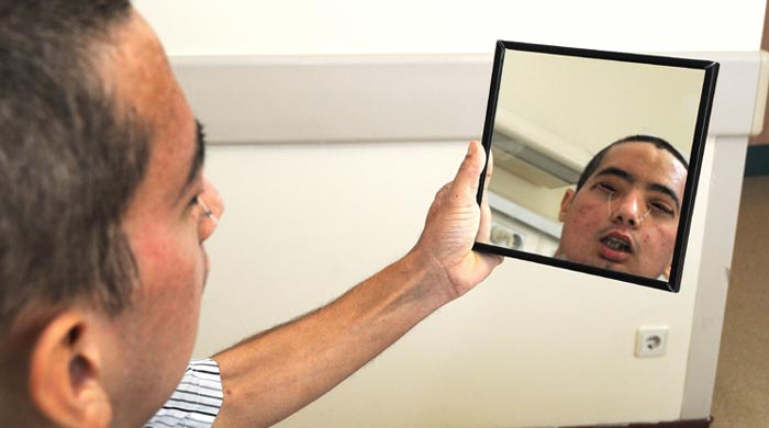 Aynada ilk defa yeni yüzünü gördü
