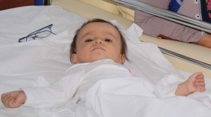 11 aylık bebeğe anjiyo yapıldı 11 aylık bebeğe anjiyo yapıldı