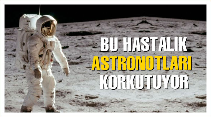 Uzay yolculuğu alzheimer yapıyor 