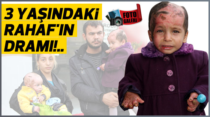 Parmaklarının yarısı olmayan Rahaf&#039;ın dramı