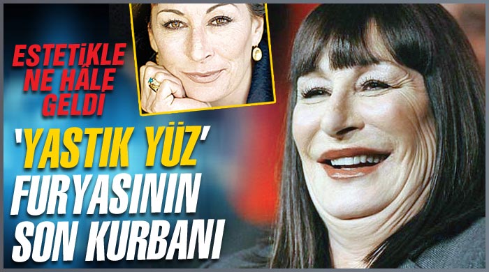 'Yastık yüz' furyasının son kurbanı 'Yastık yüz' furyasının son kurbanı