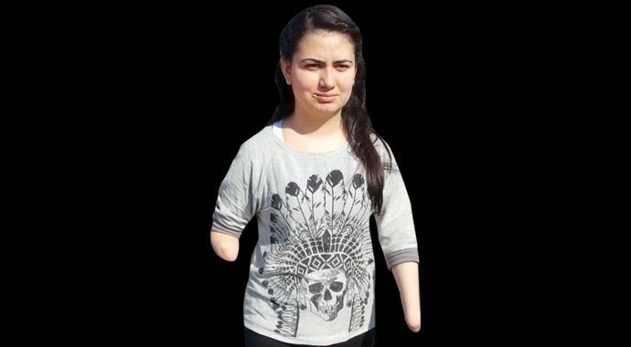 Büşra'nın dramı, Dava bitti bacak ve eller gitti Büşra'nın dramı, Dava bitti bacak ve eller gitti