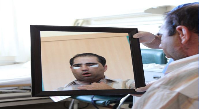 Yüz nakli olan eşinin fotoğrafını öptü Yüz nakli olan eşinin fotoğrafını öptü