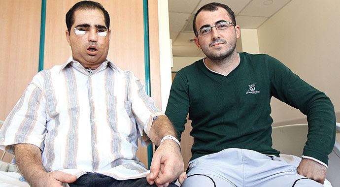Yüz naklinden sonra oğlundan bile genç görünüyor Yüz naklinden sonra oğlundan bile genç görünüyor