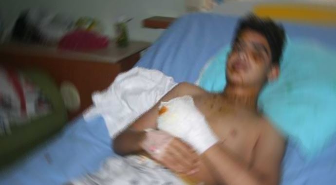 Füze saldırısında yaralanan 5 Suriyeli Türkiye&#039;de