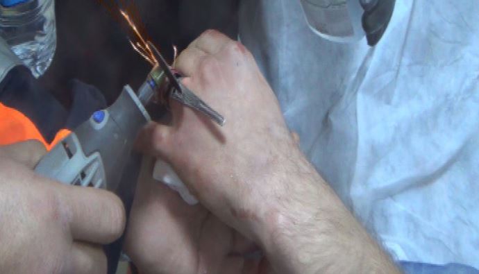 Parmakta sıkışan yüzüğü doktor da çıkaramadı Parmakta sıkışan yüzüğü doktor da çıkaramadı