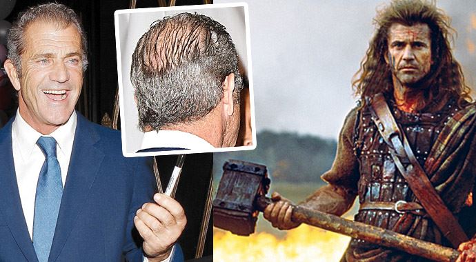 Cesur Yürek, kelini gizleyemedi