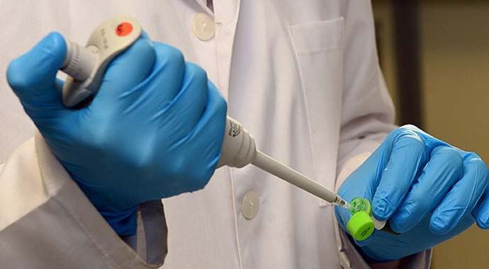 HIV virüsü taşıyan hastalar için yeni umut HIV virüsü taşıyan hastalar için yeni umut