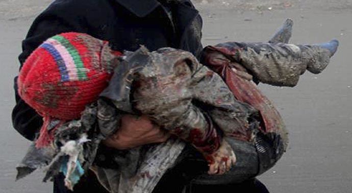 Halep'te çocuklar hedef oldu Halep'te çocuklar hedef oldu