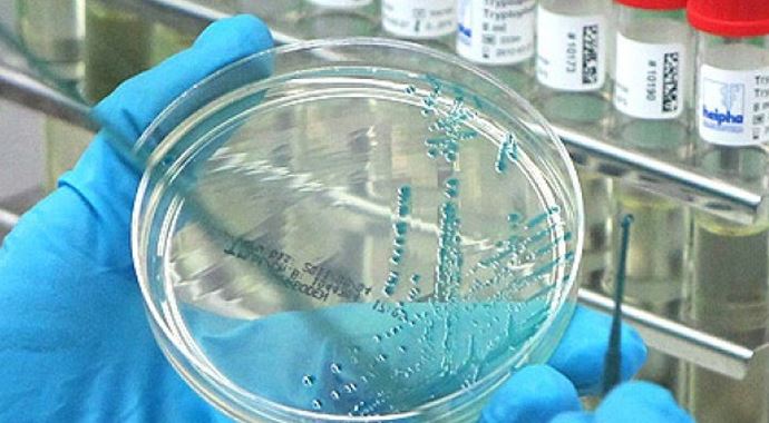 H10N8 kuş gribi virüsü insana bulaştı