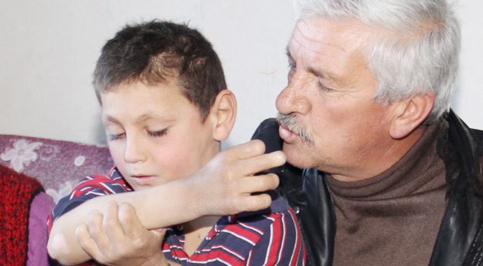 Kendi kendini yiyen çocuk!