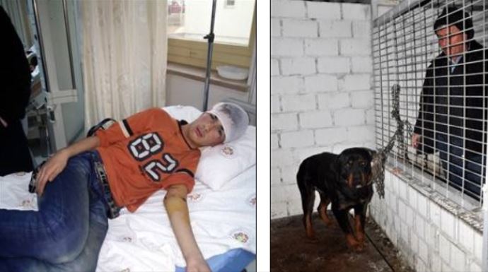 Başıboş Rottweiler çocuğu parçaladı