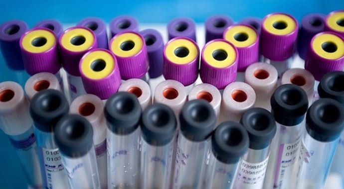 Hepatit virüsleri sinsi gelişiyor Hepatit virüsleri sinsi gelişiyor