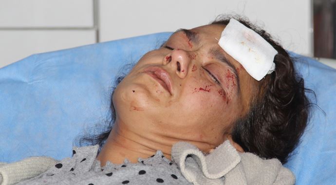 'Rızkımızı alkole verme' dedi, kocası bu hale getirdi 'Rızkımızı alkole verme' dedi, kocası bu hale getirdi