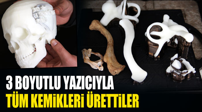 3 boyutlu yazıcıyla tüm kemikleri ürettiler