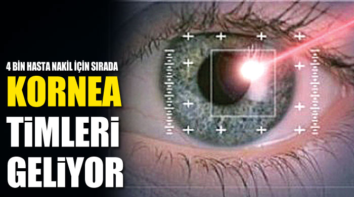 Kornea timleri geliyor Kornea timleri geliyor