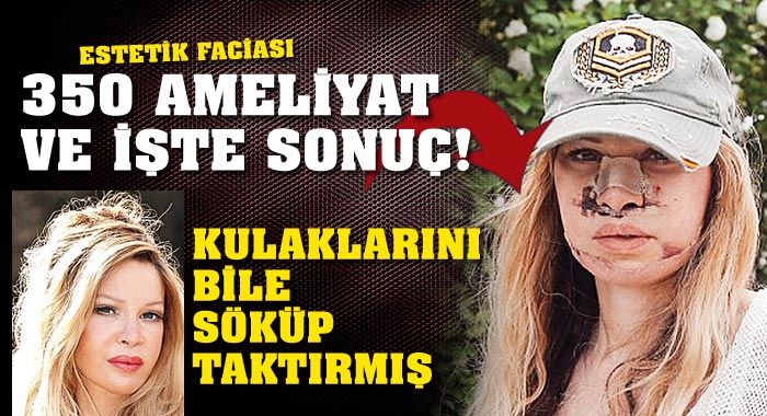 350 ameliyat ve işte sonuç