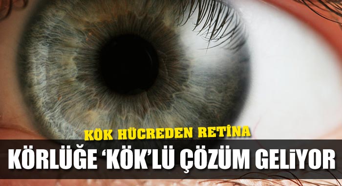 Körlüğe &#039;kök&#039;lü çözüm geliyor