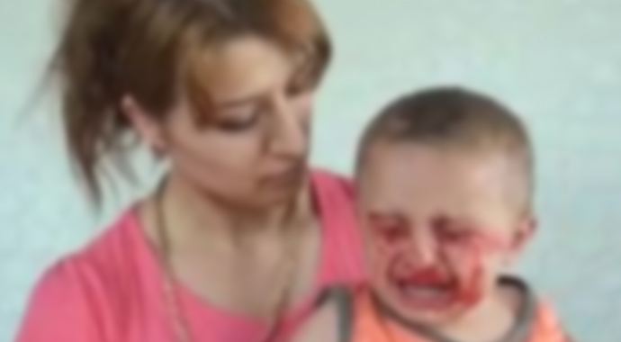 Uyuyunca gözlerinden kan akıyor Uyuyunca gözlerinden kan akıyor