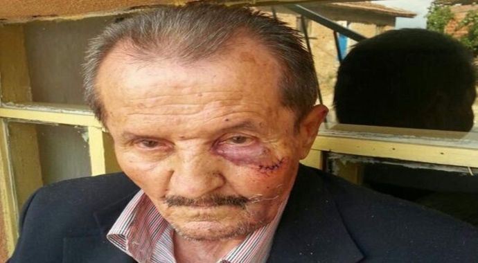 Yaşlı adamı 50 lira için darp etti