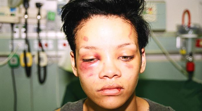 Rihanna'yı bu hale getirmenin cezası, '1000 saat yol temizliği'