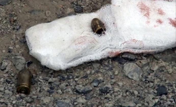 Göğsündeki mermiyi öksürerek çıkardı