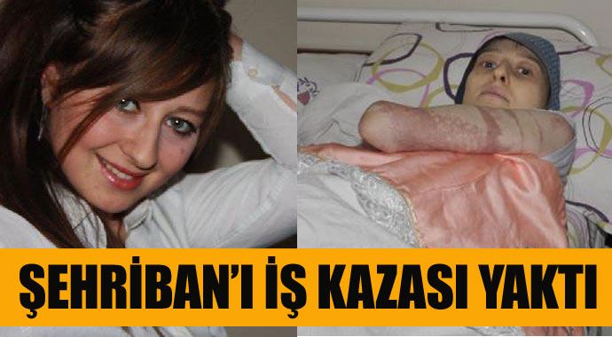 Şehriban&#039;ı iş kazası yaktı