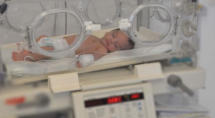 Üç günlük bebeğe yemek borusu ameliyatı 