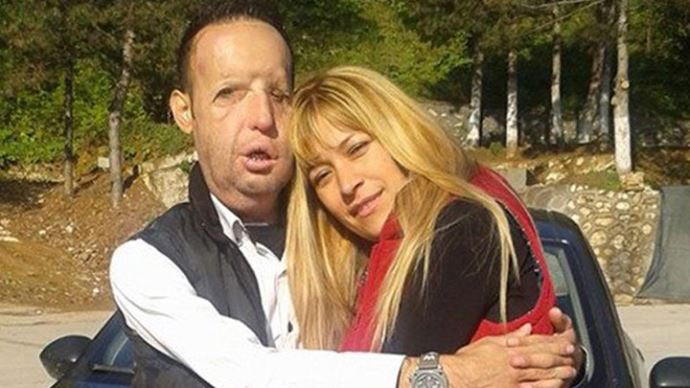 Yüz nakli olan Recep Sert&#039;ten Seda Sayan&#039;a tepki büyük!