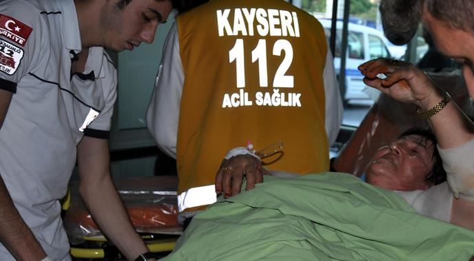 Yemek yaparken düdüklü tencere patladı, yaralandı