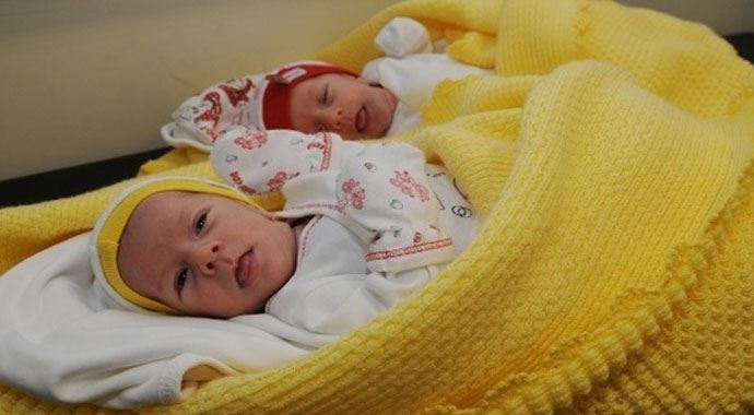 Siyam ikizleri ameliyatla ayrıldı Siyam ikizleri ameliyatla ayrıldı