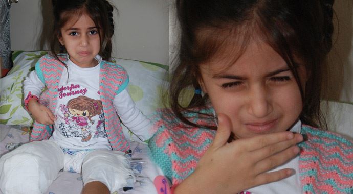 Kesilen bacağı dikilecek sanıyor Kesilen bacağı dikilecek sanıyor