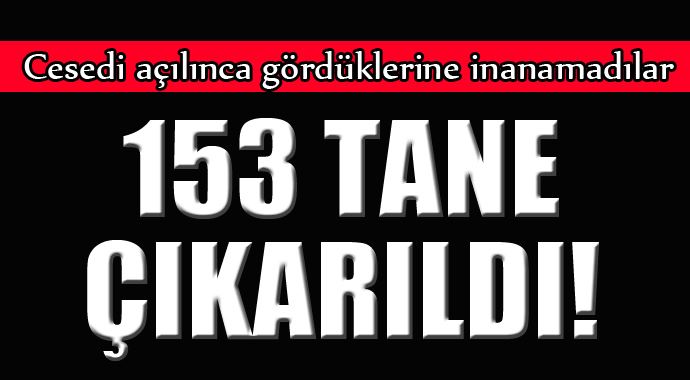 Cesedi açılınca gördüklerine inanamadılar, 153 tane çıktı! Cesedi açılınca gördüklerine inanamadılar, 153 tane çıktı!
