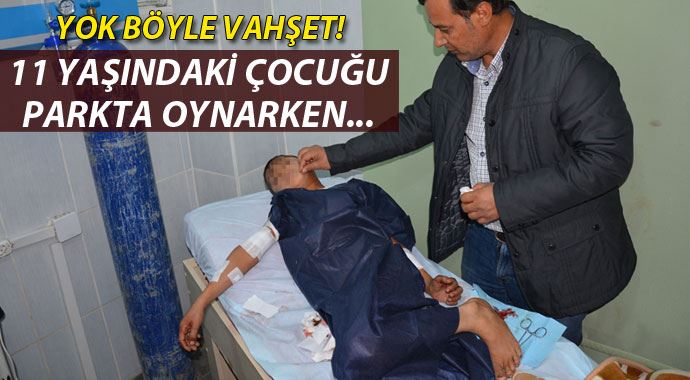 10 yaşındaki çocuk parkta oynarken 11 yerinden bıçaklandı 10 yaşındaki çocuk parkta oynarken 11 yerinden bıçaklandı