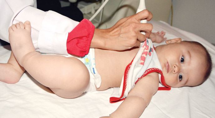 5 aylık bebeğe anjiyo! 5 aylık bebeğe anjiyo!