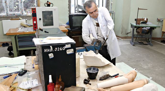 Kolu yok! Kol-bacak üretiyor Kolu yok! Kol-bacak üretiyor