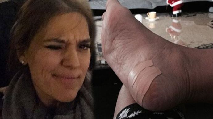 Demet Akalın&#039;ın ayakları sosyal medyayı salladı