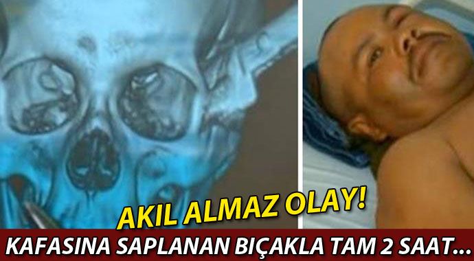 Başına saplanan bıçakla iki saat araba kullandı Başına saplanan bıçakla iki saat araba kullandı
