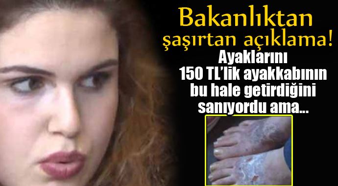 Bakanlıktan zehirli ayakkabı açıklaması Bakanlıktan zehirli ayakkabı açıklaması