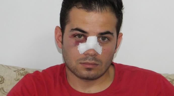 Kırmızı kart gösteren hakemin burnunu kırdı Kırmızı kart gösteren hakemin burnunu kırdı