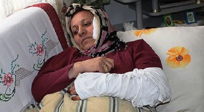 Aday gösterilmedi kendini yaktı 